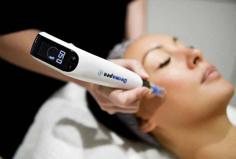 Dermapen 4 Anwendung im Gesicht bei Beauty Secrets