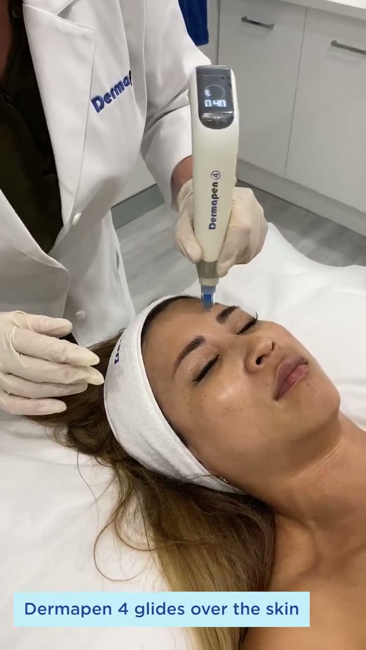 Dermapen 4 in der Anwendung