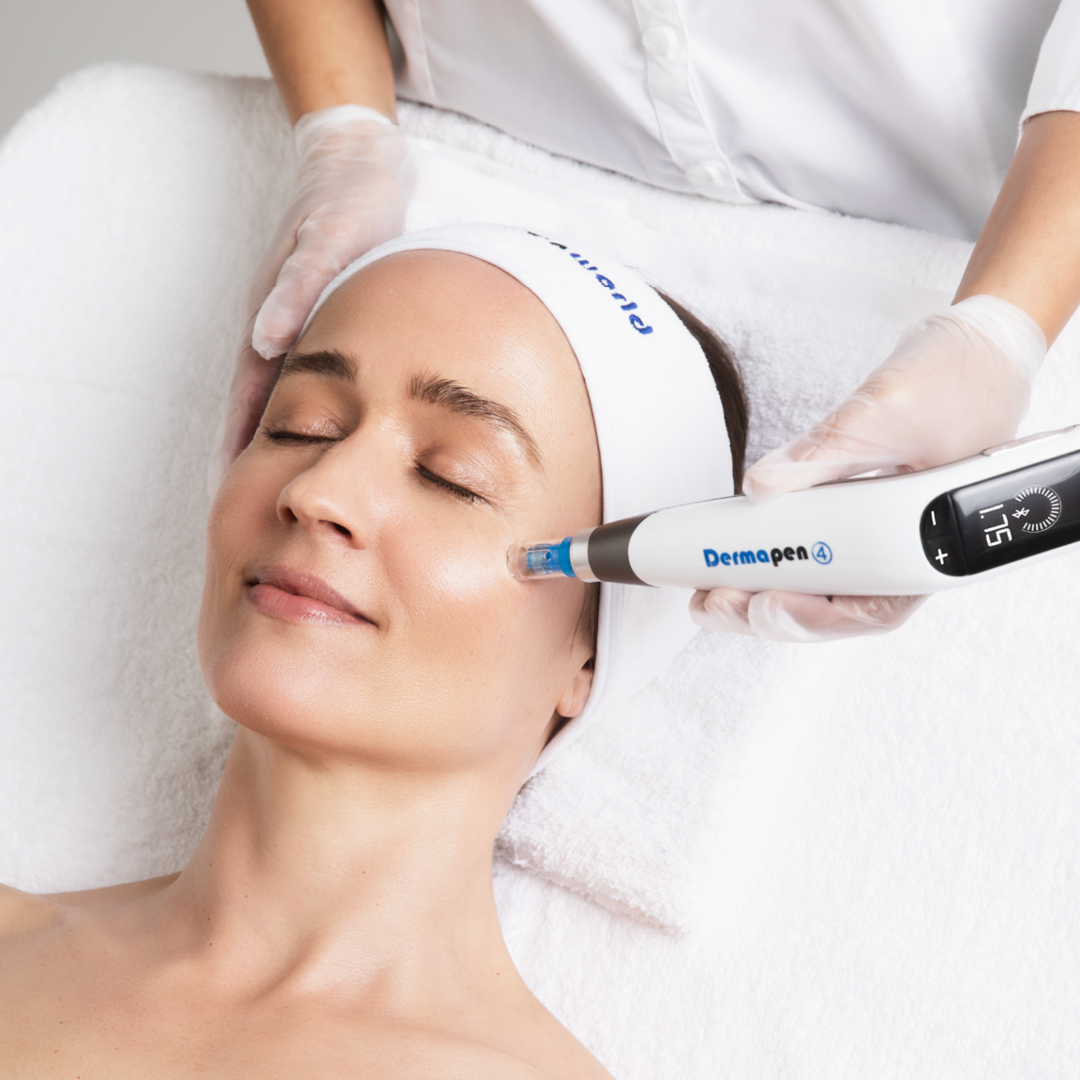 Dermapen 4 Microneedling im Gesicht bei Beauty Secrets in Wedel
